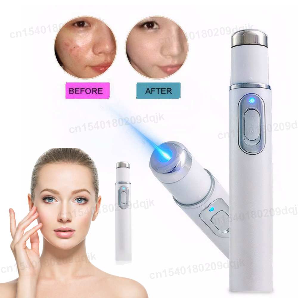 Acne Light Therapy Pen - العلاج بالضوء الأزرق قلم حب الشباب